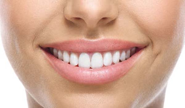 Implantes en odontologia